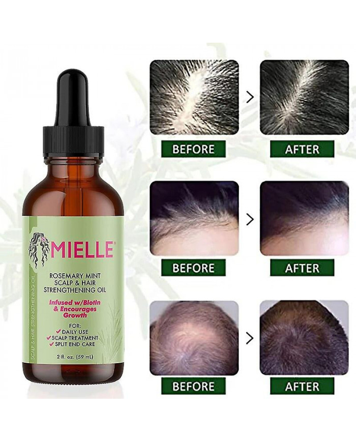 Huile essentielle de croissance des cheveux Romarin Menthe Huile fortifiante pour les cheveux Traitement [...]