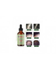 Huile essentielle de croissance des cheveux Romarin Menthe Huile fortifiante pour les cheveux Traitement [...]