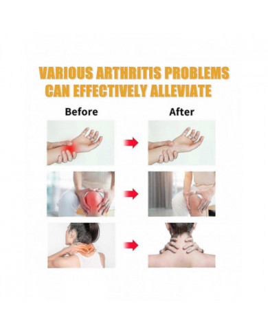 2pcs Gel de soin professionnel au venin d’abeille, gel de soin des articulations au venin d’abeille