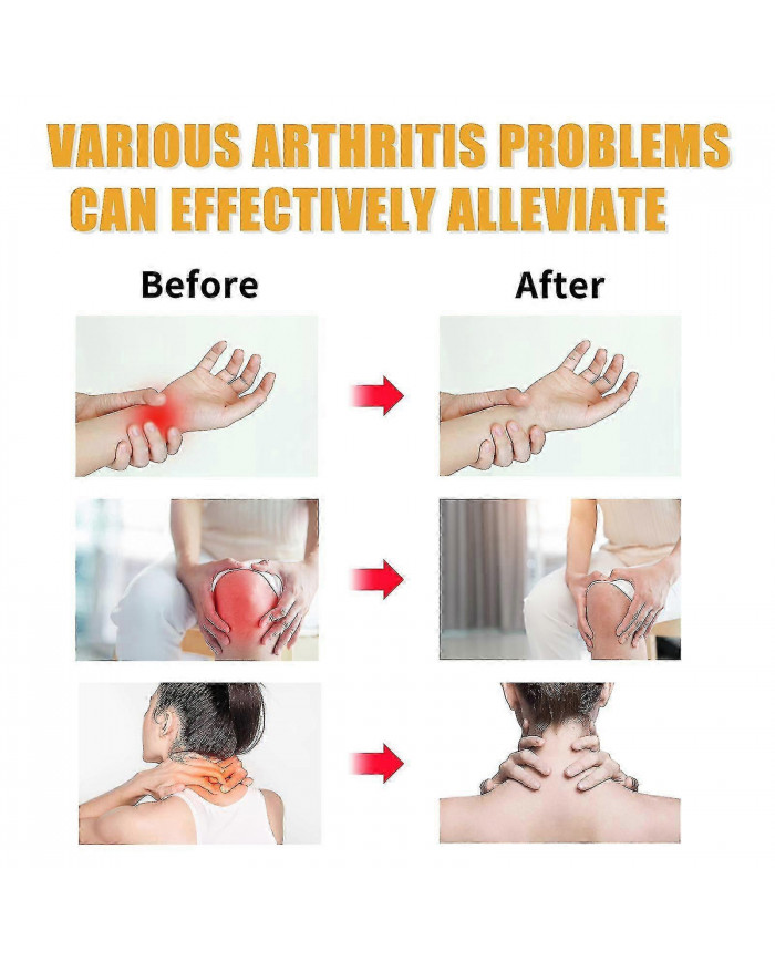 2pcs Gel de soin professionnel au venin d’abeille, gel de soin des articulations au venin d’abeille