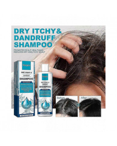 Dermatite séborrhéique Psoriasis Shampooing-cuir chevelu Traitement Pour Folliculite Psoriasis Sèche Démangeaisons [...]