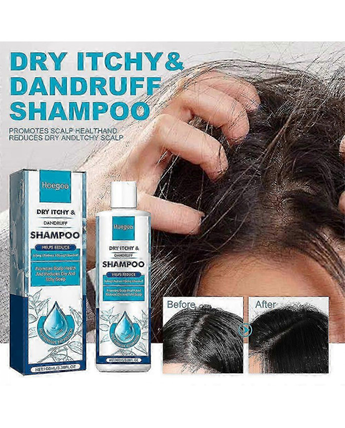 Dermatite séborrhéique Psoriasis Shampooing-cuir chevelu Traitement Pour Folliculite Psoriasis Sèche Démangeaisons [...]