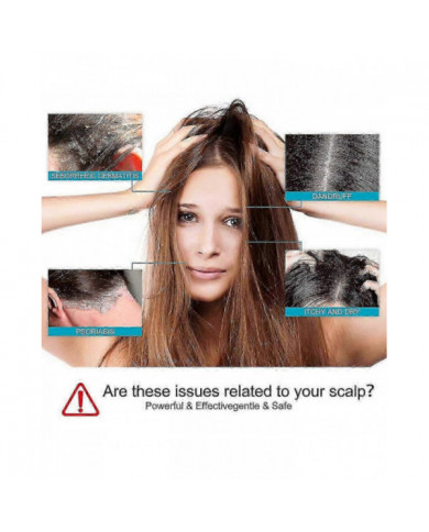 Dermatite séborrhéique Psoriasis Shampooing-cuir chevelu Traitement Pour Folliculite Psoriasis Sèche Démangeaisons [...]