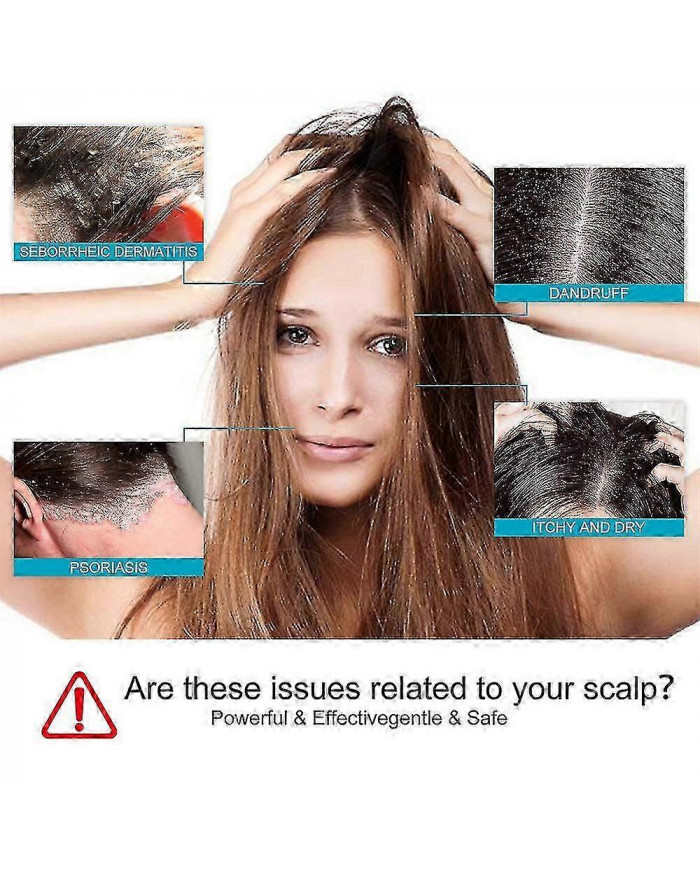 Dermatite séborrhéique Psoriasis Shampooing-cuir chevelu Traitement Pour Folliculite Psoriasis Sèche Démangeaisons [...]