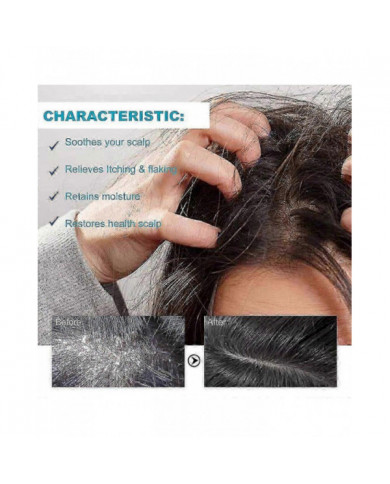 Dermatite séborrhéique Psoriasis Shampooing-cuir chevelu Traitement Pour Folliculite Psoriasis Sèche Démangeaisons [...]