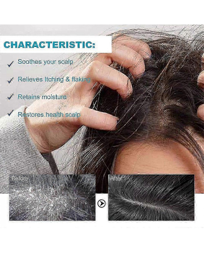 Dermatite séborrhéique Psoriasis Shampooing-cuir chevelu Traitement Pour Folliculite Psoriasis Sèche Démangeaisons [...]