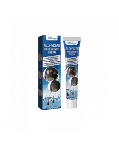 1-3X Nouvelle Crème de Traitement de l’Alopécie Croissance des Cheveux Prévenir L’Alopécie Caldness Repousse 20g