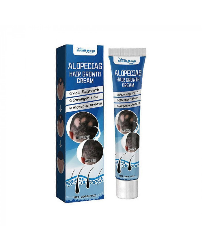 1-3X Nouvelle Crème de Traitement de l’Alopécie Croissance des Cheveux Prévenir L’Alopécie Caldness Repousse 20g