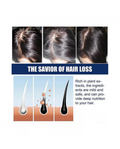 1-3X Nouvelle Crème de Traitement de l’Alopécie Croissance des Cheveux Prévenir L’Alopécie Caldness Repousse 20g