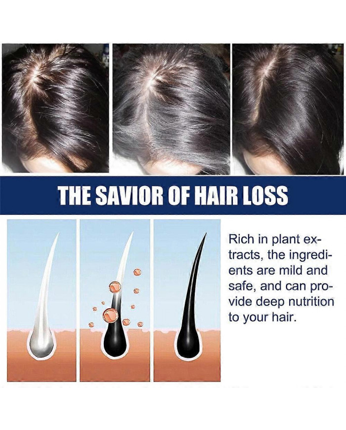 1-3X Nouvelle Crème de Traitement de l’Alopécie Croissance des Cheveux Prévenir L’Alopécie Caldness Repousse 20g