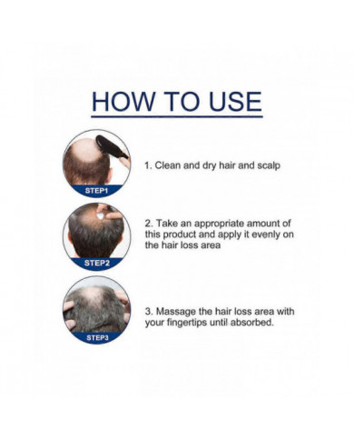 1-3X Nouvelle Crème de Traitement de l’Alopécie Croissance des Cheveux Prévenir L’Alopécie Caldness Repousse 20g