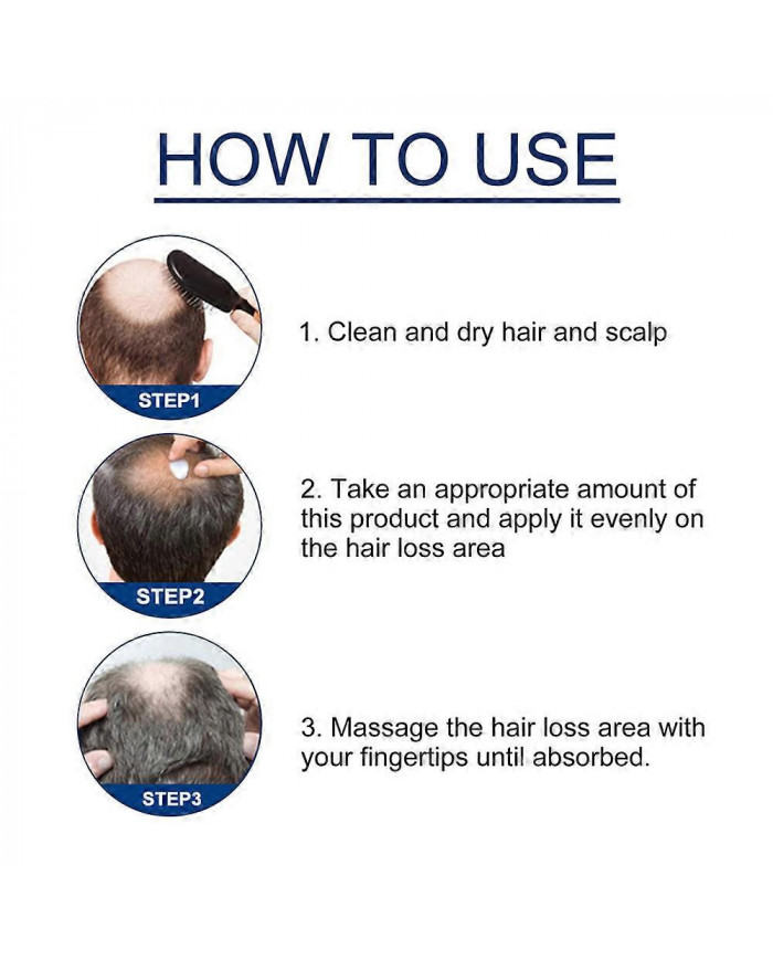 1-3X Nouvelle Crème de Traitement de l’Alopécie Croissance des Cheveux Prévenir L’Alopécie Caldness Repousse 20g