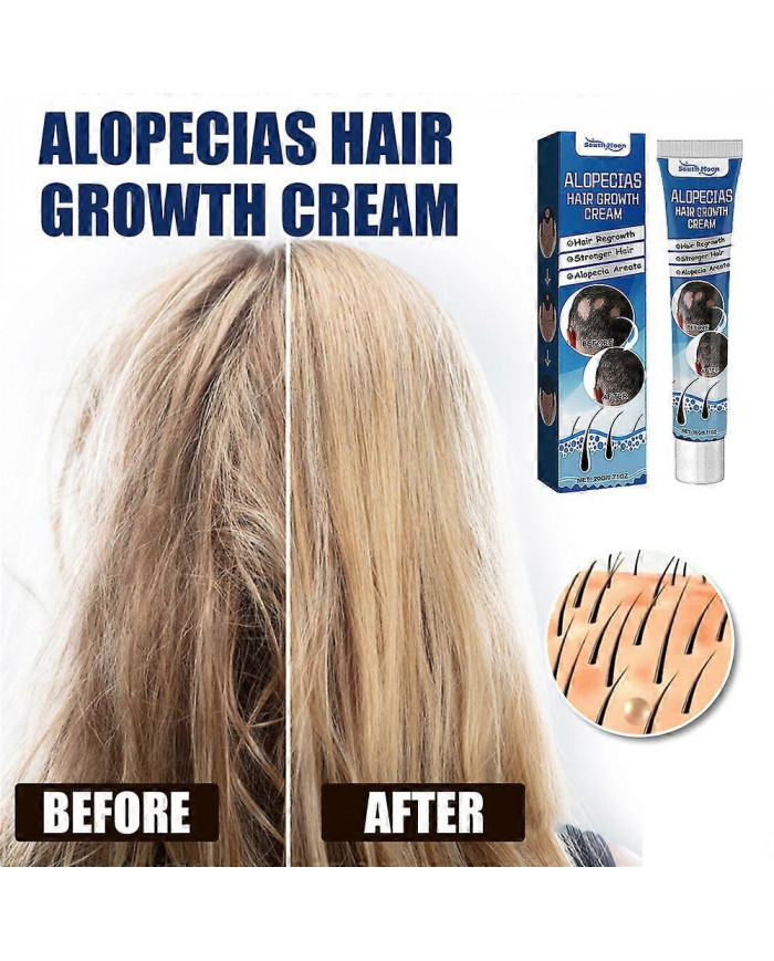 1-3X Nouvelle Crème de Traitement de l’Alopécie Croissance des Cheveux Prévenir L’Alopécie Caldness Repousse 20g