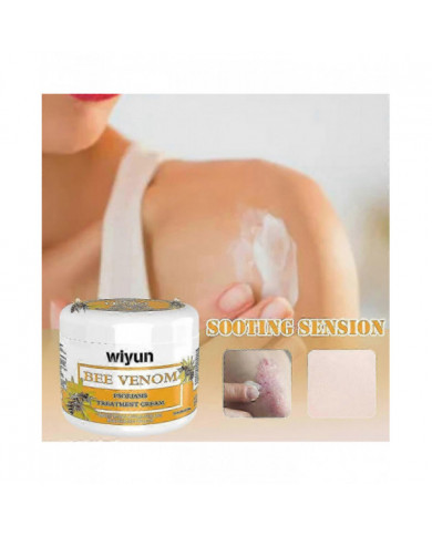 3/5pcs Psoriasises Crème, Sérum d’abeille Psoriasises Crème Soulagement de la peau Crème anti-démangeaisons [...]