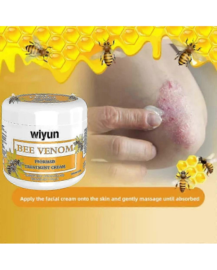 3/5pcs Psoriasises Crème, Sérum d’abeille Psoriasises Crème Soulagement de la peau Crème anti-démangeaisons [...]