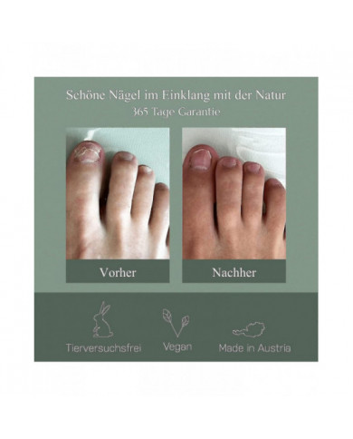 2024 -Stylo de soin des ongles, Expériences autrichiennes de champignon des ongles, Expériences de stylo de soin [...]