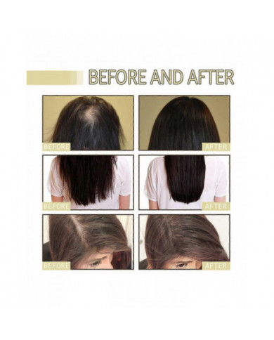 1-3Pcs Nouvelle Huile Naturelle De Croissance Des Cheveux, Veganic Naturel Huile De Croissance Des Cheveux 60ml