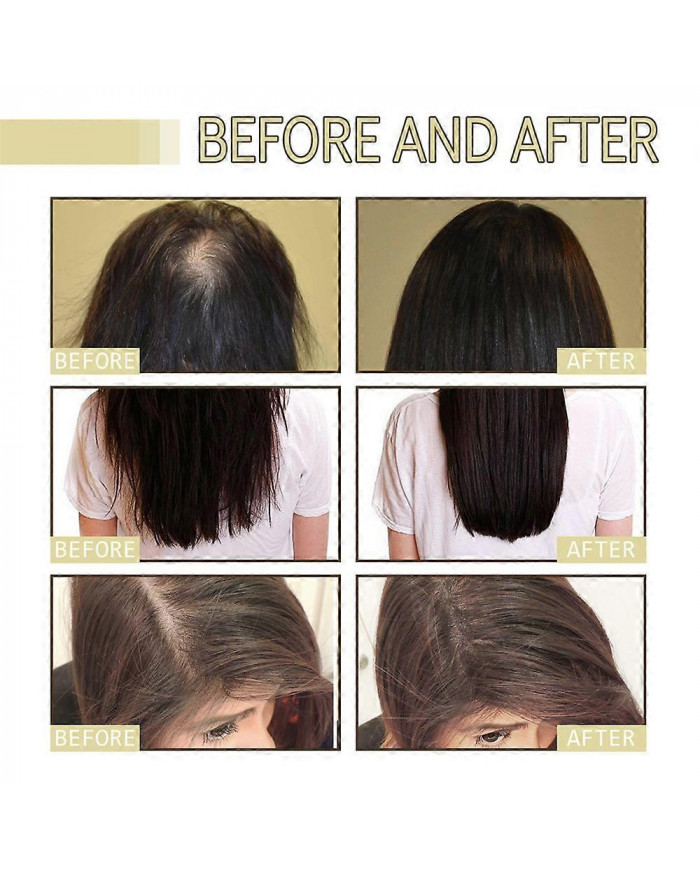 1-3Pcs Nouvelle Huile Naturelle De Croissance Des Cheveux, Veganic Naturel Huile De Croissance Des Cheveux 60ml