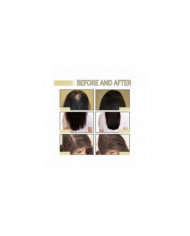 1-3Pcs Nouvelle Huile Naturelle De Croissance Des Cheveux, Veganic Naturel Huile De Croissance Des Cheveux 60ml