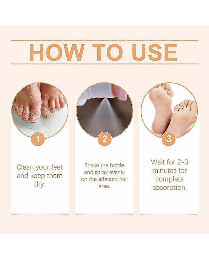 Traitements fongiques Spray pour ongle Ongle Ongle Antifongiques super fort Liquide pour tous les types d’ongles