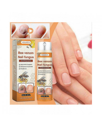 Traitements fongiques Spray pour ongle Ongle Ongle Antifongiques super fort Liquide pour tous les types d’ongles