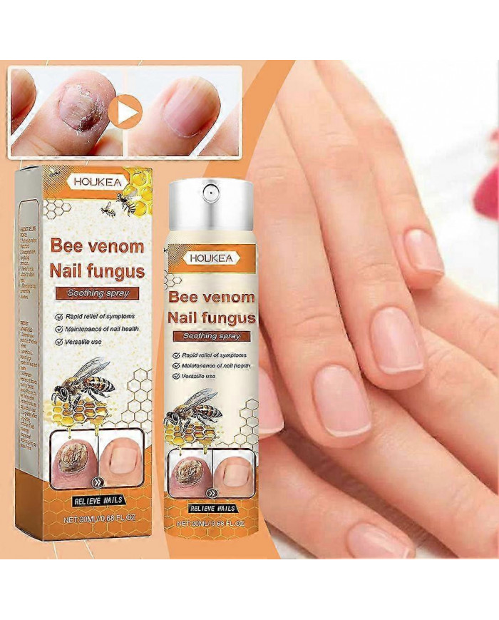 Traitements fongiques Spray pour ongle Ongle Ongle Antifongiques super fort Liquide pour tous les types d’ongles
