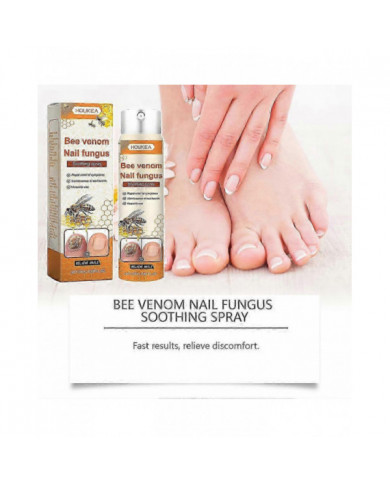 Traitements fongiques Spray pour ongle Ongle Ongle Antifongiques super fort Liquide pour tous les types d’ongles