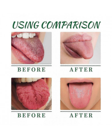 Spray réparateur de langue, éliminateur d’odeurs buccales pour la sécheresse et la mauvaise haleine, spray de [...]