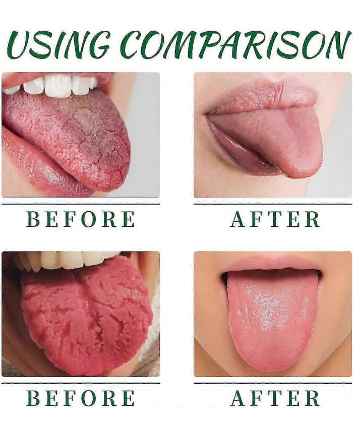 Spray réparateur de langue, éliminateur d’odeurs buccales pour la sécheresse et la mauvaise haleine, spray de [...]