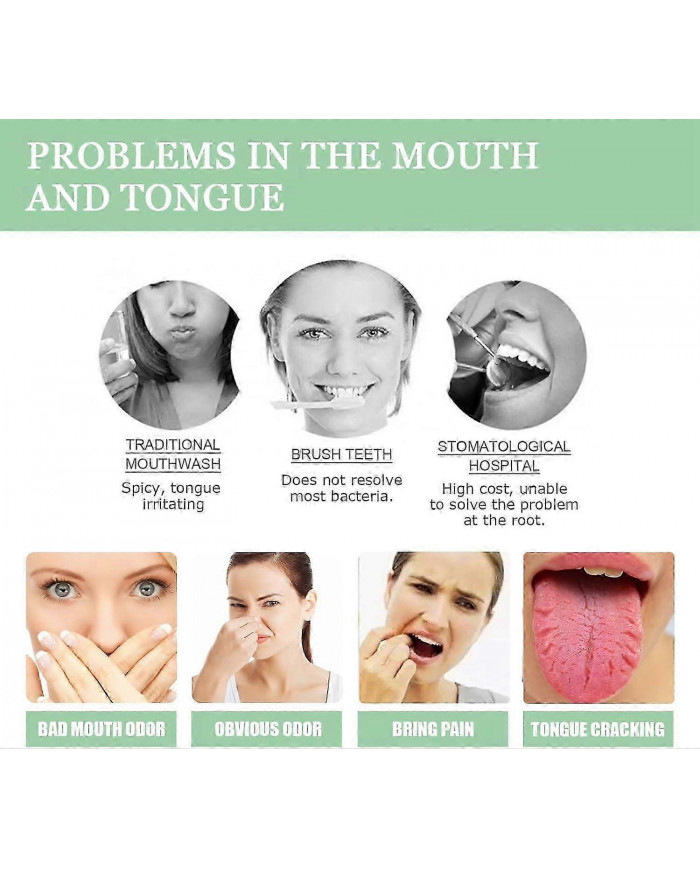 Spray réparateur de langue, éliminateur d’odeurs buccales pour la sécheresse et la mauvaise haleine, spray de [...]