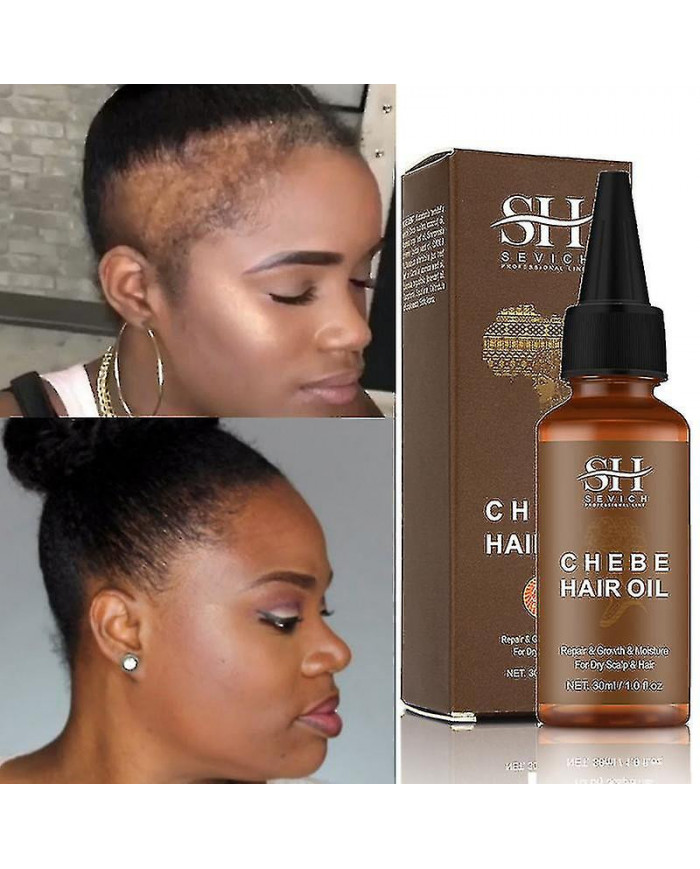 African Chebe Oil Hair Strengthener Chebe Extreme Hair Growth Spray Fast Edges Growth Alopecia Hair Oil Hair Loss [...]
