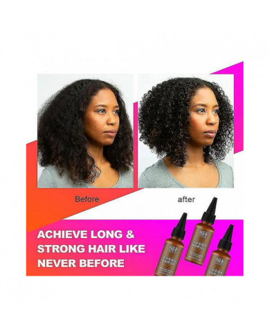 African Chebe Oil Hair Strengthener Chebe Extreme Hair Growth Spray Fast Edges Growth Alopecia Hair Oil Hair Loss [...]