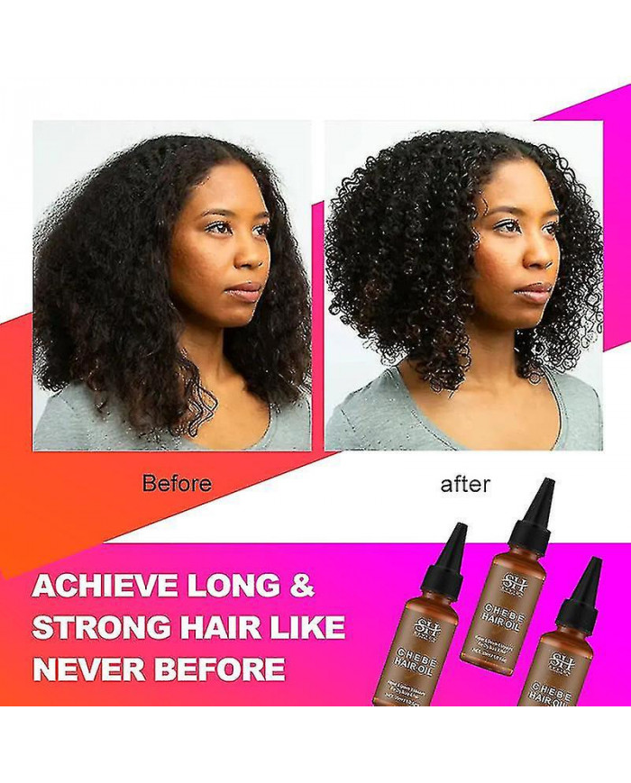 African Chebe Oil Hair Strengthener Chebe Extreme Hair Growth Spray Fast Edges Growth Alopecia Hair Oil Hair Loss [...]