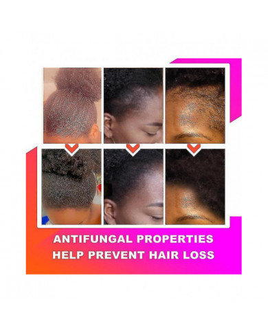 African Chebe Oil Hair Strengthener Chebe Extreme Hair Growth Spray Fast Edges Growth Alopecia Hair Oil Hair Loss [...]