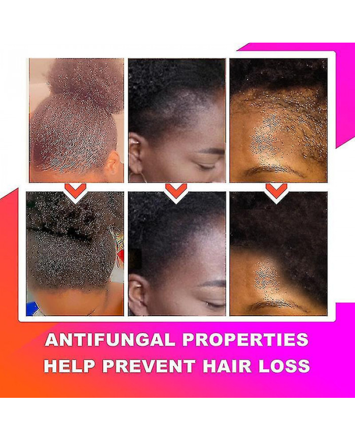 African Chebe Oil Hair Strengthener Chebe Extreme Hair Growth Spray Fast Edges Growth Alopecia Hair Oil Hair Loss [...]