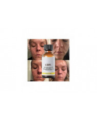 50% Peel Chimique Tca Peel Acide Peau Superforce Peel Pigmentation Éclaircissement Mélanine Traitement de l’acné [...]