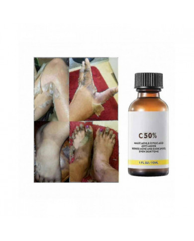 50% Peel Chimique Tca Peel Acide Peau Superforce Peel Pigmentation Éclaircissement Mélanine Traitement de l’acné [...]