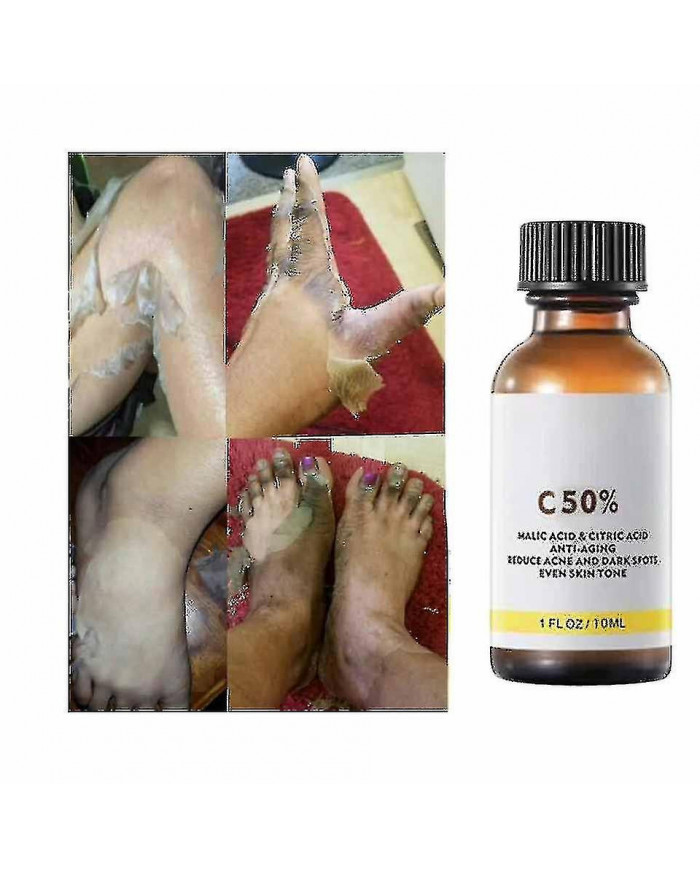 50% Peel Chimique Tca Peel Acide Peau Superforce Peel Pigmentation Éclaircissement Mélanine Traitement de l’acné [...]