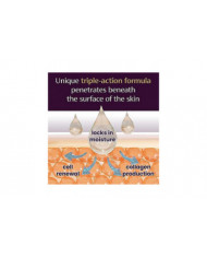 Mederma Advanced Gel pour cicatrices 0,70 oz (20 g)