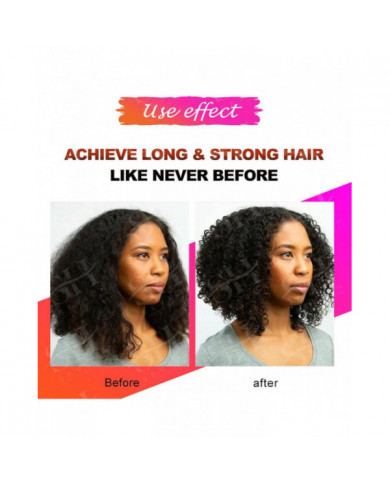 Essence de croissance rapide des cheveux Traitement naturel de la santé à base de plantes La perte de cheveux fait [...]