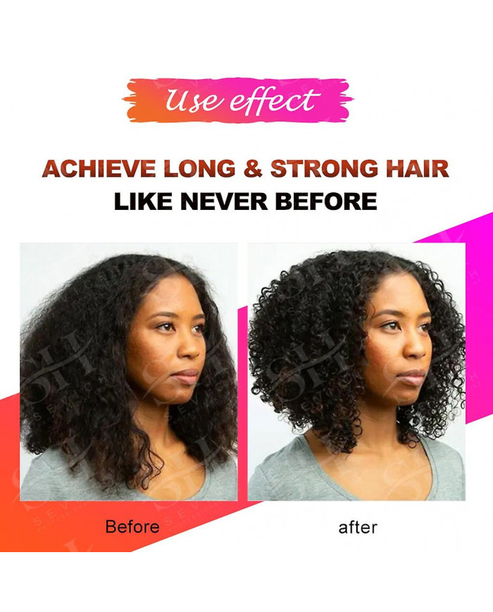 Essence de croissance rapide des cheveux Traitement naturel de la santé à base de plantes La perte de cheveux fait [...]