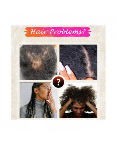 Essence de croissance rapide des cheveux Traitement naturel de la santé à base de plantes La perte de cheveux fait [...]