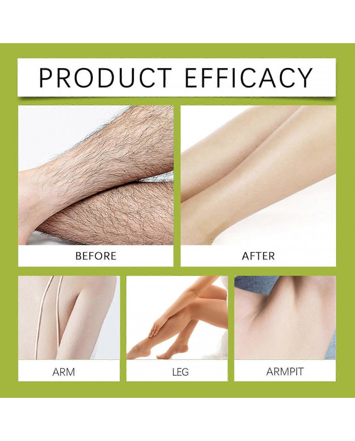 Huile de Cyperus Rotundus topique, Huile d’herbe de noix 100% naturelle, Huile de Cyperus Rotundus pour [...]