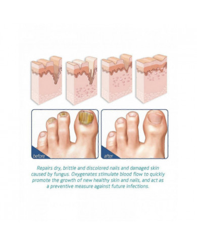 1-10xOnycostop Pro Pied et Ongle Spary Pied Traitement des odeurs Spray Sérum de croissance des ongles