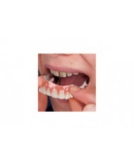 Extra Thin Fake Bright White Tooth Faceers Silicone Soft Safe Adhesive Denture Hide Hide Shade Braces Comfortable [...]