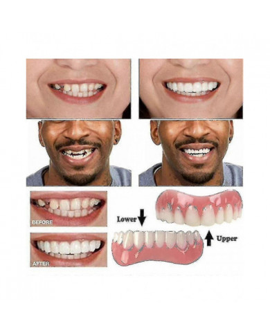 Extra Thin Fake Bright White Tooth Faceers Silicone Soft Safe Adhesive Denture Hide Hide Shade Braces Comfortable [...]