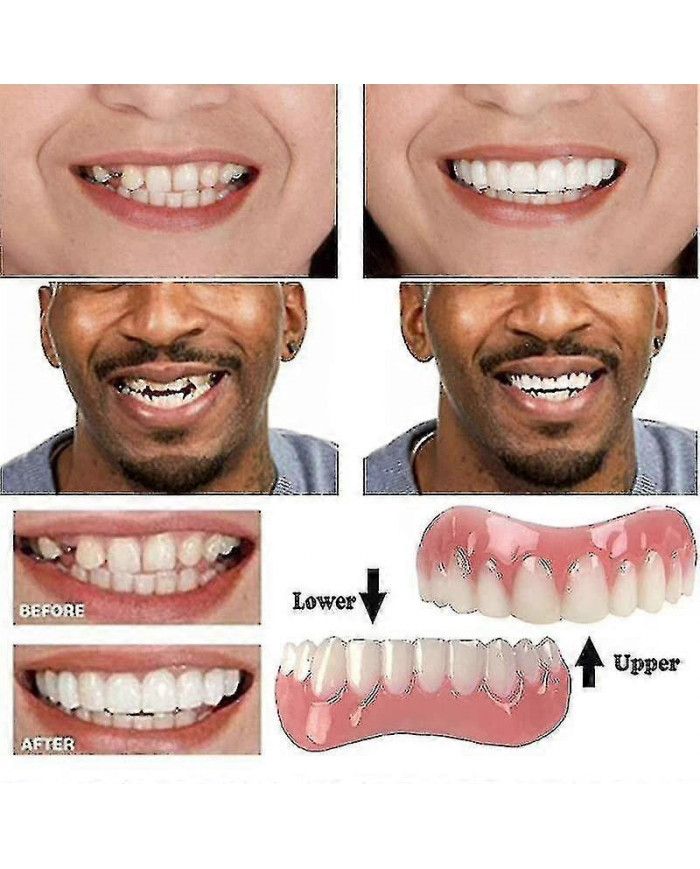 Extra Thin Fake Bright White Tooth Faceers Silicone Soft Safe Adhesive Denture Hide Hide Shade Braces Comfortable [...]