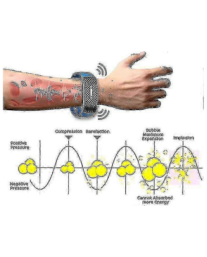 Bracelet Sculptant Corporel À Ultrasons, Bracelets Magnétiques Drainage Lymphatique Pour Tous Hommes Et Femmes - Dian