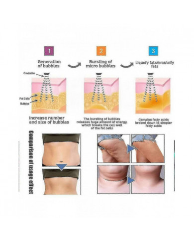 Bracelet magnétique de haute technologie en forme de corps à ultrasons-komo Lymph Drainage Magnetic Bracelet