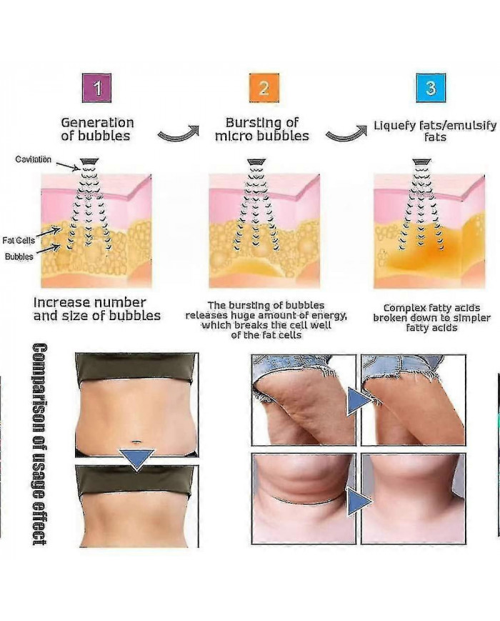 Bracelet magnétique de haute technologie en forme de corps à ultrasons-komo Lymph Drainage Magnetic Bracelet